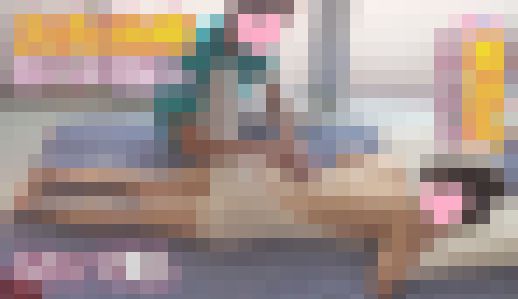 【再販】彼にお灸治療をしてもらってからセックスしちゃった?